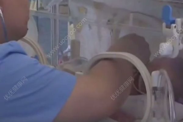 新生兒患上溶血癥，經(jīng)歷了兩次全身“大換血”，溶血癥的癥狀(4)