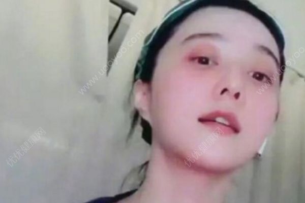 范冰冰頭等艙中做美容，自創(chuàng)按摩法揉得一臉紅腫(1)