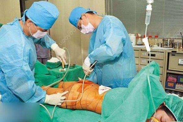 女子隆胸又抽脂手術(shù)時(shí)身亡，隆胸抽脂有哪些風(fēng)險(xiǎn)？(2)