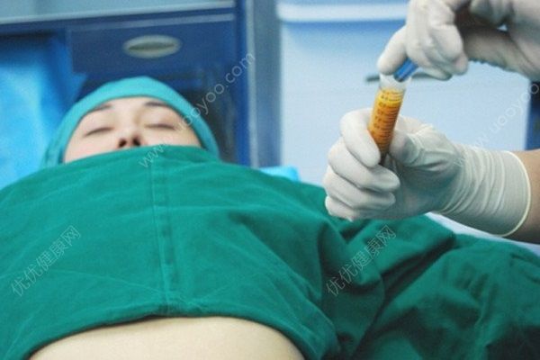 女子隆胸又抽脂手術(shù)時(shí)身亡，隆胸抽脂有哪些風(fēng)險(xiǎn)？(4)