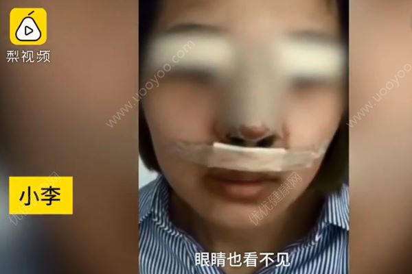 想當(dāng)網(wǎng)絡(luò)主播貸款3萬(wàn)整容，結(jié)果遭“毀容”(1)