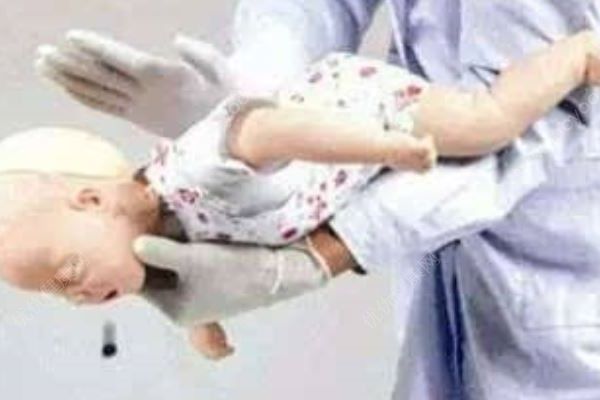 2歲女童奶糖卡喉，女護(hù)士“伸手”被咬出血，異物卡喉如何緊急施救(2)