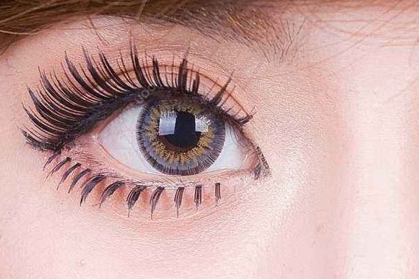 女子高中時(shí)開始戴美瞳，十年下來兩眼的角膜嚴(yán)重缺氧(2)