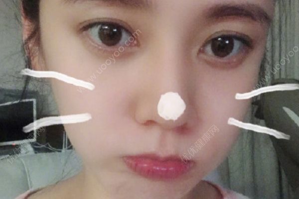 秋瓷炫懷孕九月自拍，孕晚期的注意事項(xiàng)有哪些？(2)