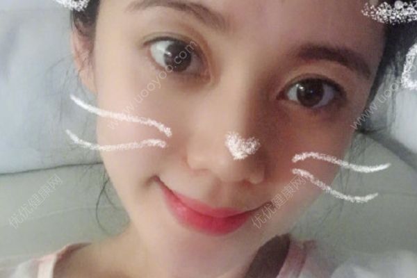 秋瓷炫懷孕九月自拍，孕晚期的注意事項(xiàng)有哪些？(3)