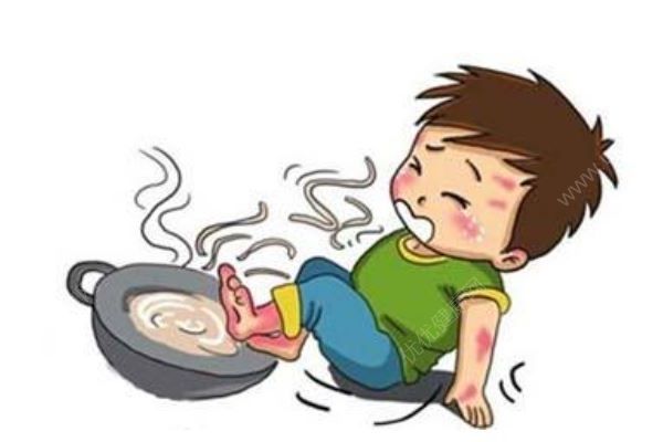 4歲男孩一屁股坐進(jìn)開水桶，全身65%燙傷，燙傷急救處理方法(1)
