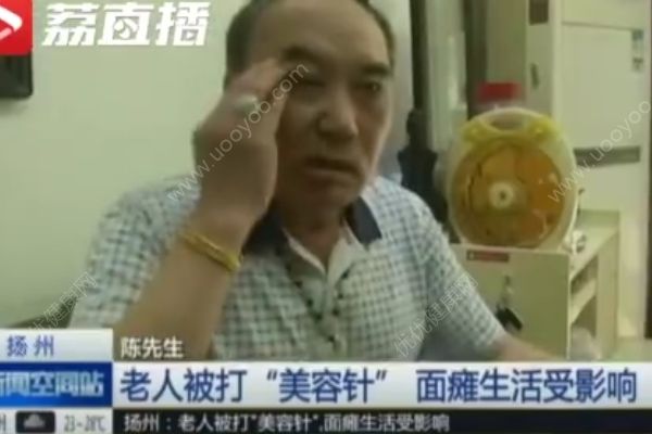 免費打美容針，六旬男子面癱“沒臉出門”(1)