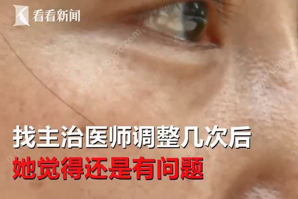 女子整容后一下子老了十多歲，醫(yī)院稱自己資質(zhì)合法(4)