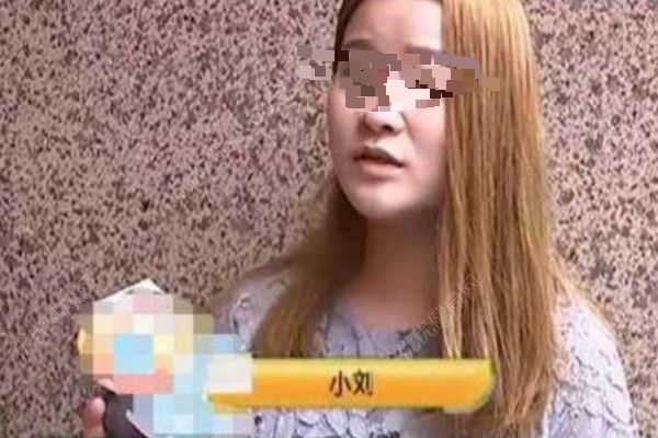 女子花5300元割雙眼皮，3年后想退款：左眼是四眼皮(2)