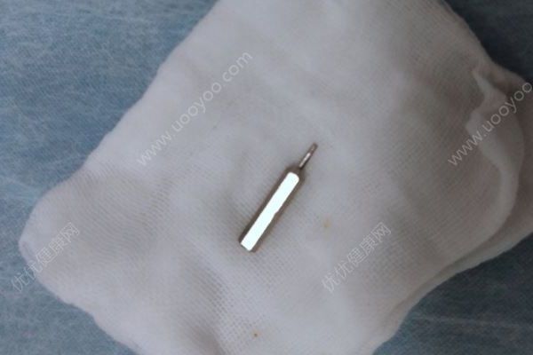 16個月男孩誤吞螺絲刀頭，2小時手術(shù)異物安全取出(4)