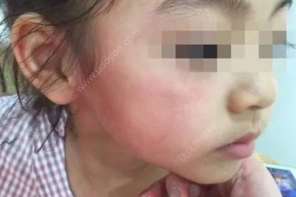 4歲女孩被掌摑，小朋友玩耍起沖突 一方媽媽成主角(3)
