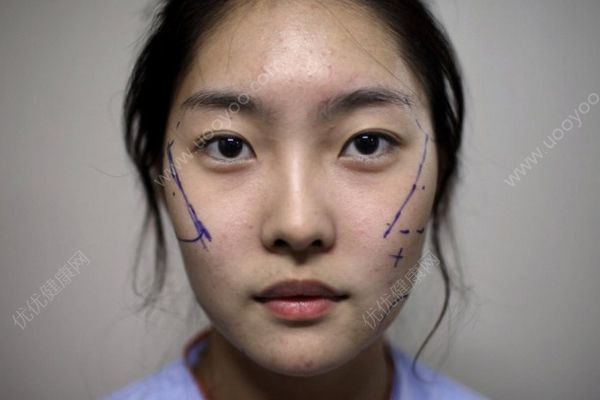 她整容整歪鼻子，如今藥不離身：事后才知被無(wú)證醫(yī)生拿來(lái)練手(2)