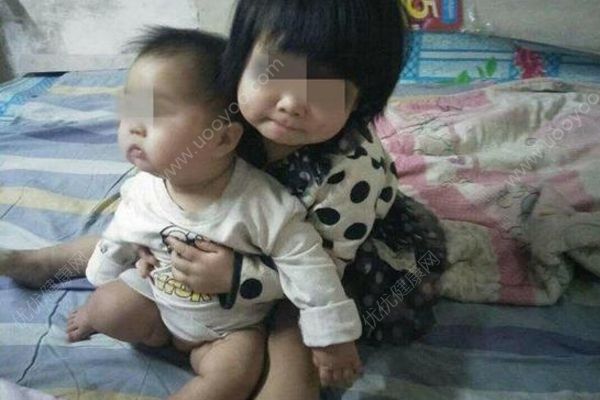 媽媽下樓扔垃圾，4歲和1歲姐妹從5樓窗口墜下重傷(1)