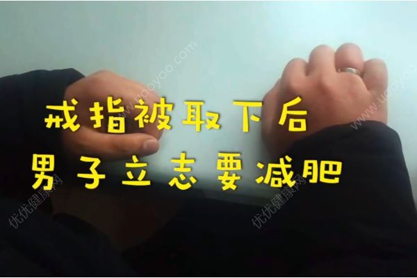 男子春節(jié)吃的太胖，戒指卡手上取不下來(4)