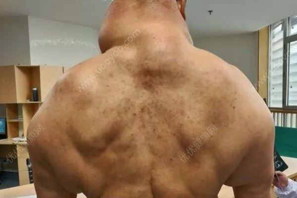 每天2斤白酒，脖子比腰粗，大爺喝酒55年成綠巨人(4)