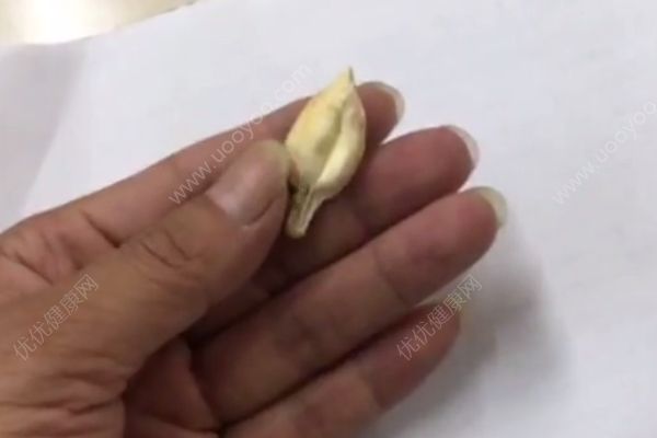 市民煮魚掉出稀罕物有人開價百萬，魚寶很值錢嗎？(3)