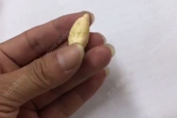 市民煮魚掉出稀罕物有人開價百萬，魚寶很值錢嗎？(4)