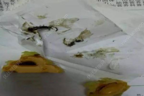嚇人！女子吃桃嘴唇一陣刺痛，桃核里面鉆出一條蜈蚣(2)