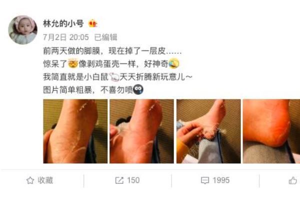林允回應(yīng)公開(kāi)撕腳皮，“接地氣”說(shuō)辭遭群嘲(1)