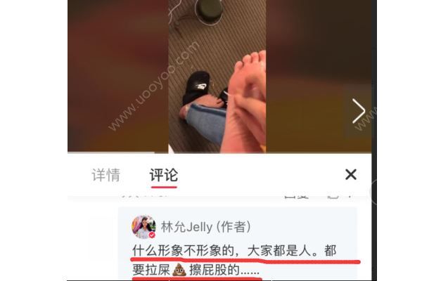 林允回應(yīng)公開(kāi)撕腳皮，“接地氣”說(shuō)辭遭群嘲(2)