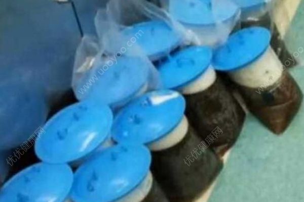 69歲大媽患婦科腫瘤肚鼓如球，醫(yī)生抽出30多升囊液(3)