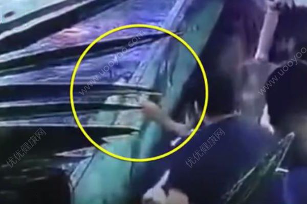 女童被商場(chǎng)鯊魚咬傷致手部骨折，母親：它突然跳起(3)