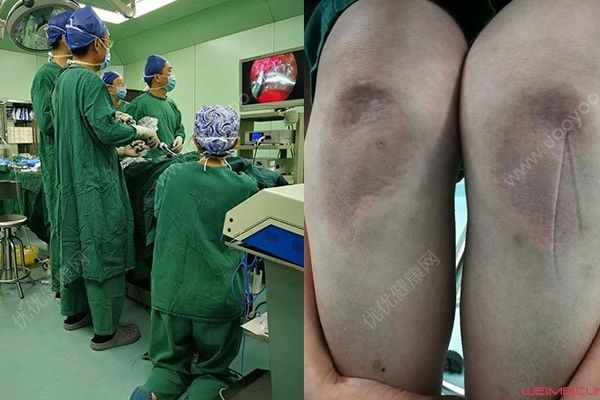 為救護(hù)士腿部跪出青紫，家人曾一度想放棄(1)