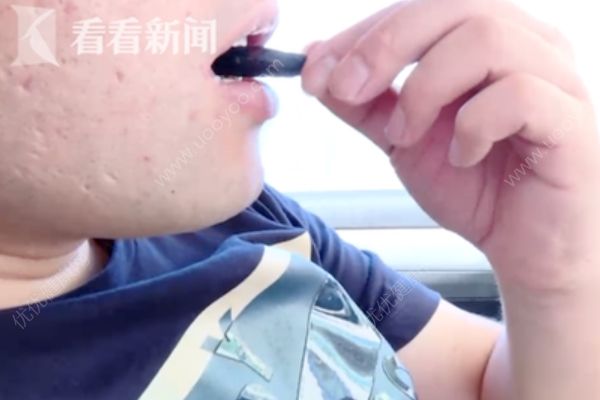 男子每天吃5包檳榔連吃10年患癌，長(zhǎng)期吃檳榔小心口腔癌！(1)