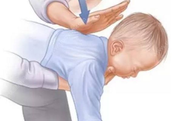 7歲男孩腹痛近1周，醫(yī)生取出8厘米棒棒糖棍子(4)
