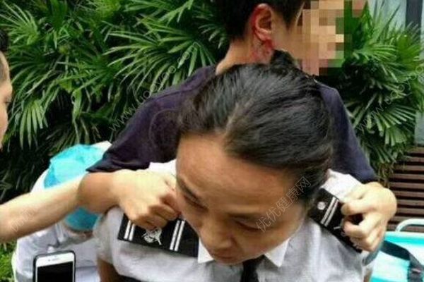 未栓繩德牧咬傷13歲少年，狗主人被拘留10日罰500元(1)