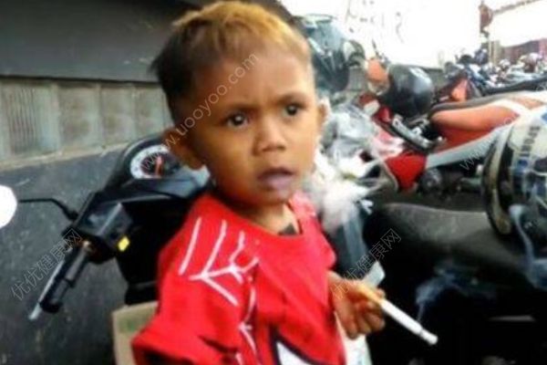 2歲男孩吸煙成癮，媽媽每天要給他買(mǎi)兩包煙(2)