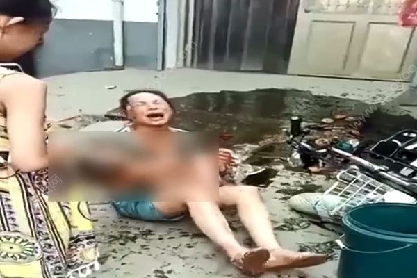 電動(dòng)車撞翻早餐攤油鍋，1歲半男娃被熱油從頭澆下(1)