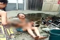電動車撞翻早餐攤油鍋，1歲半男娃被熱油從頭澆下[多圖]