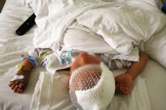 4歲娃被鄰居大狗咬掉頭皮，親屬：跑4家醫(yī)院都不收[多圖]