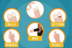 女子手撕倒刺不料進(jìn)了醫(yī)院，嚴(yán)重可能要截肢！長(zhǎng)倒刺怎么辦[多圖]