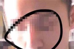 男子不滿隆鼻效果畫符扎娃娃詛咒，醫(yī)院：無理取鬧[多圖]