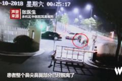 男子圍觀情侶吵架，被咬掉鼻尖，情侶間如何避免吵架？[多圖]