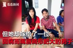 美女離婚改嫁畸形嘴丑男，前夫指責“她一定是為了錢”[多圖]