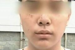 打籃球13歲少年被抓成花臉，如何解決廣場舞擾民問題[多圖]