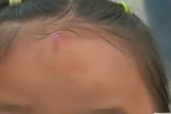 又見高空拋物！4歲女童被煙盒砸傷[多圖]