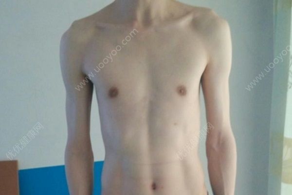 青少年偏瘦怎么辦？青少年如何增肥？(1)