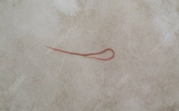 紅線蟲是什么樣子的？紅線蟲有什么作用？(2)