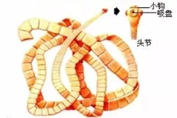女子體內(nèi)取出13厘米長的活蟲！這種傻事可別再做了(4)