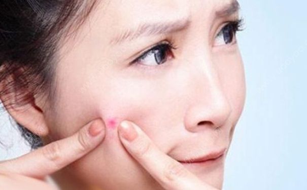 抽煙會(huì)長(zhǎng)痘痘嗎？抽煙有什么害處？(2)