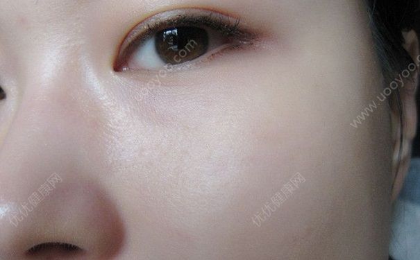 不整容怎么變漂亮？不化妝怎么變漂亮？(5)
