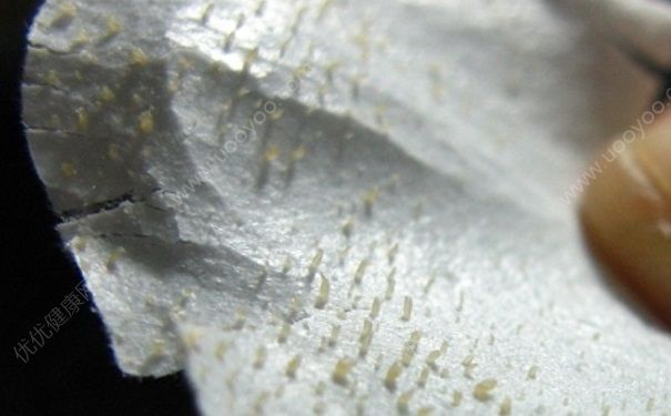 卸妝水能去黑頭嗎？用卸妝水可以去黑頭嗎？(4)
