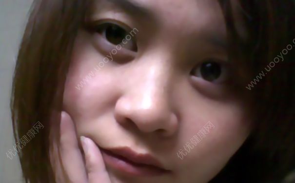 睡眠不足有眼袋怎么辦？睡眠不足有黑眼圈怎么辦？(2)
