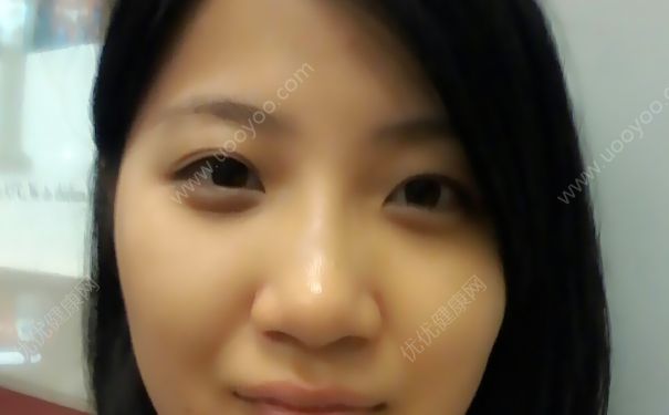 睡眠不足有眼袋怎么辦？睡眠不足有黑眼圈怎么辦？(3)