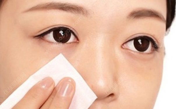 光子嫩膚能祛黑頭么？光子嫩膚可以去黑頭嗎？(1)