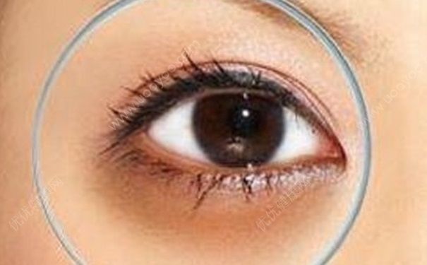 黑眼圈能做手術嗎？光子嫩膚能去黑眼圈嗎？(2)